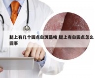 腿上有几个圆点白斑是啥 腿上有白圆点怎么回事