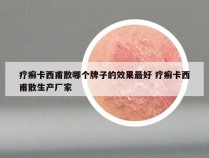 疗癣卡西甫散哪个牌子的效果最好 疗癣卡西甫散生产厂家