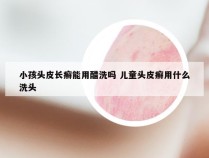 小孩头皮长癣能用醋洗吗 儿童头皮癣用什么洗头