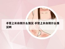 手臂上长白斑什么情况 手臂上长白斑什么情况啊