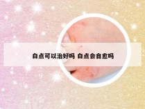 白点可以治好吗 白点会自愈吗