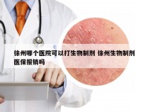 徐州哪个医院可以打生物制剂 徐州生物制剂医保报销吗