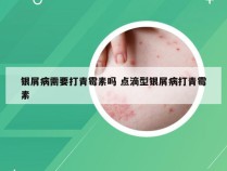 银屑病需要打青霉素吗 点滴型银屑病打青霉素