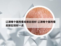 辽源哪个医院看皮肤比较好 辽源哪个医院看皮肤比较好一点