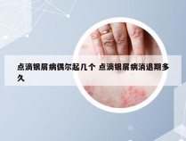 点滴银屑病偶尔起几个 点滴银屑病消退期多久