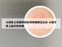 小孩身上有癣样的红块特别痒怎么办 小孩子身上起红色的癣