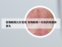 生物制剂几针见效 生物制剂一针的药效维持多久