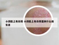 小孩脸上有白斑 小孩脸上有白斑是缺什么维生素