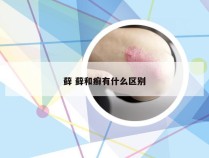 藓 藓和癣有什么区别