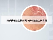 四岁孩子脸上长白斑 4岁小孩脸上长白斑