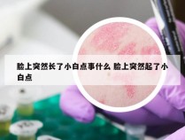 脸上突然长了小白点事什么 脸上突然起了小白点