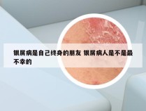 银屑病是自己终身的朋友 银屑病人是不是最不幸的