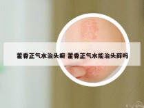 藿香正气水治头癣 藿香正气水能治头藓吗