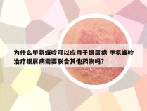 为什么甲氨蝶呤可以应用于银屑病 甲氨蝶呤治疗银屑病需要联合其他药物吗?