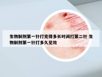 生物制剂第一针打完得多长时间打第二针 生物制剂第一针打多久见效