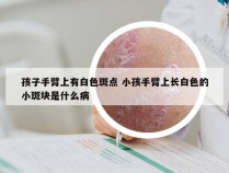 孩子手臂上有白色斑点 小孩手臂上长白色的小斑块是什么病