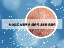 刮痧能否治银屑病 刮痧可以用银镯刮吗