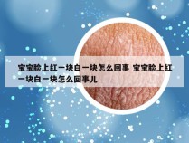 宝宝脸上红一块白一块怎么回事 宝宝脸上红一块白一块怎么回事儿