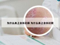 为什么身上会长红癣 为什么身上会长红斑