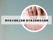 初中生小孩身上出癣 孩子身上的癣怎么除根