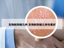 生物制剂哪几种 生物制剂哪几种效果好