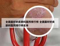 全国最好的皮肤科医院排行榜 全国最好的皮肤科医院排行榜名单