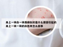 身上一块白一块像癣似的是什么原因引起的 身上一块一块的白色斑怎么回事