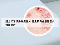 腿上长了很多白点图片 腿上长白点点是怎么回事图片