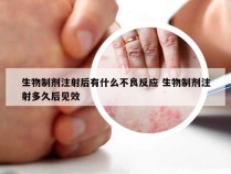 生物制剂注射后有什么不良反应 生物制剂注射多久后见效