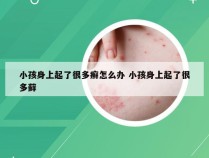 小孩身上起了很多癣怎么办 小孩身上起了很多藓