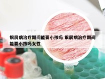 银屑病治疗期间能要小孩吗 银屑病治疗期间能要小孩吗女性