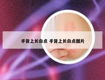 手背上长白点 手背上长白点图片