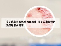 孩子头上有红色癣怎么回事 孩子头上红色的斑点是怎么回事