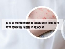 银屑病注射生物制剂有保险报销吗 银屑病注射生物制剂有保险报销吗多少钱