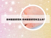 郑州银屑研究所 郑州银屑研究所怎么样?