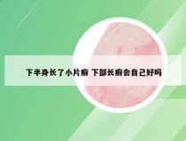 下半身长了小片癣 下部长癣会自己好吗