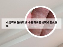 小腿有白色的斑点 小腿有白色的斑点怎么回事