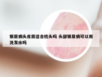 银屑病头皮屑适合梳头吗 头部银屑病可以用洗发水吗