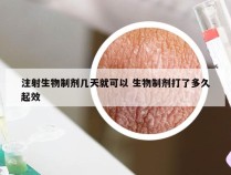 注射生物制剂几天就可以 生物制剂打了多久起效