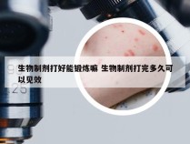 生物制剂打好能锻炼嘛 生物制剂打完多久可以见效