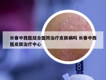 长春中西医结合医院治疗皮肤病吗 长春中西医皮肤治疗中心