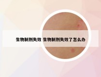 生物制剂失效 生物制剂失效了怎么办