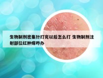 生物制剂密集针打完以后怎么打 生物制剂注射部位红肿痒咋办