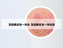 发现眼皮有一块白 发现眼皮有一块白斑