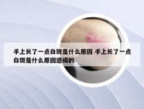 手上长了一点白斑是什么原因 手上长了一点白斑是什么原因造成的