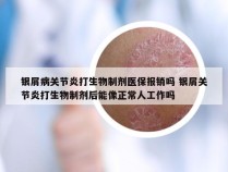 银屑病关节炎打生物制剂医保报销吗 银屑关节炎打生物制剂后能像正常人工作吗