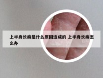 上半身长癣是什么原因造成的 上半身长癣怎么办