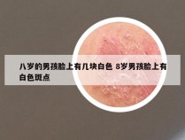 八岁的男孩脸上有几块白色 8岁男孩脸上有白色斑点