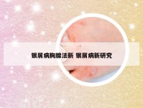 银屑病胸腺法新 银屑病新研究