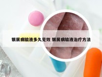 银屑病输液多久见效 银屑病输液治疗方法